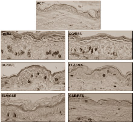 Muscles Remember Past Glory Muscles Remember Past Glory