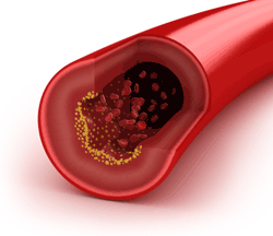 Fountain of Youth in Your Muscles? Researchers Uncover Muscle-Stem Cell Mechanism in Aging