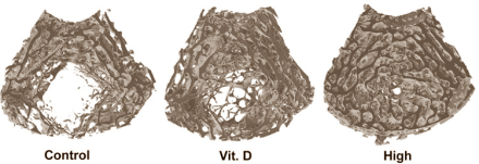 Suppression of human growth hormone may ward off cancer, diabetes