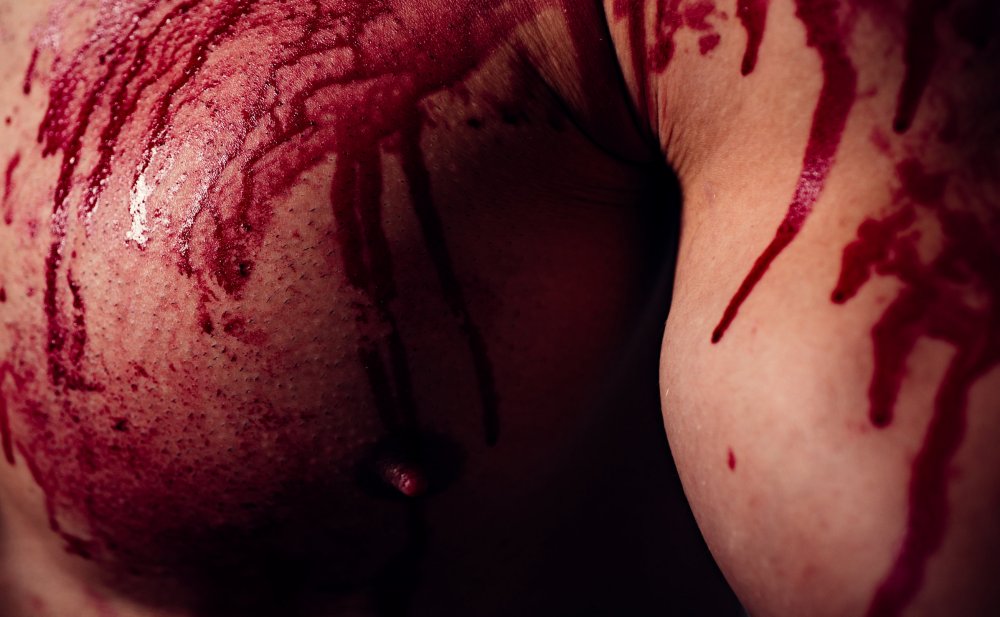 Is Bodybuilding Any More Dangerous Than Other Professional Sports?