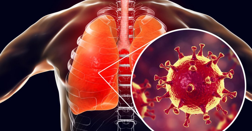 Can Exercise Help You Avoid Pneumonia?