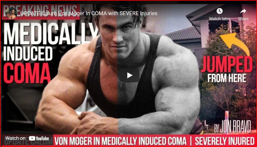 UPDATE Calum Von Moger In COMA with SEVERE Injuries