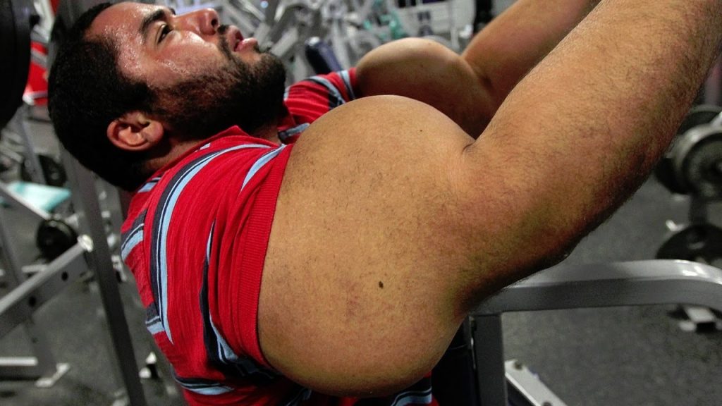 Where Do We Draw The Line? Where Do We Draw The Line?