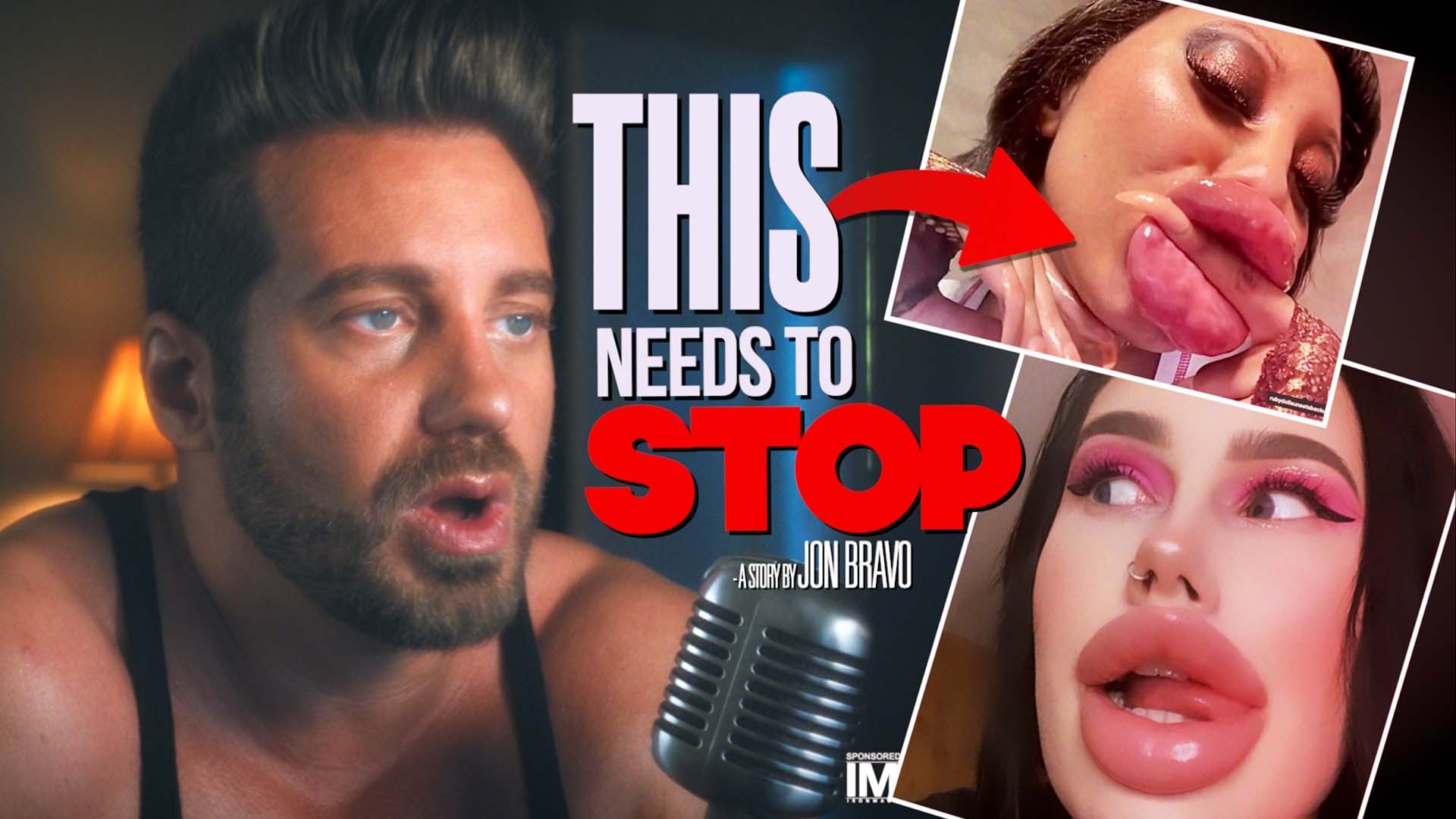 LIPS ARE GETTING OUT OF CONTROL!