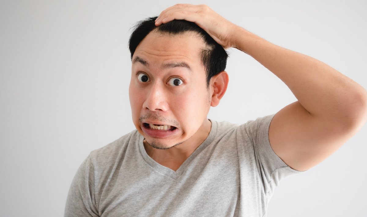 A Detailed Guide to Male Pattern Baldness and the Treatments A Detailed Guide to Male Pattern Baldness and the Treatments