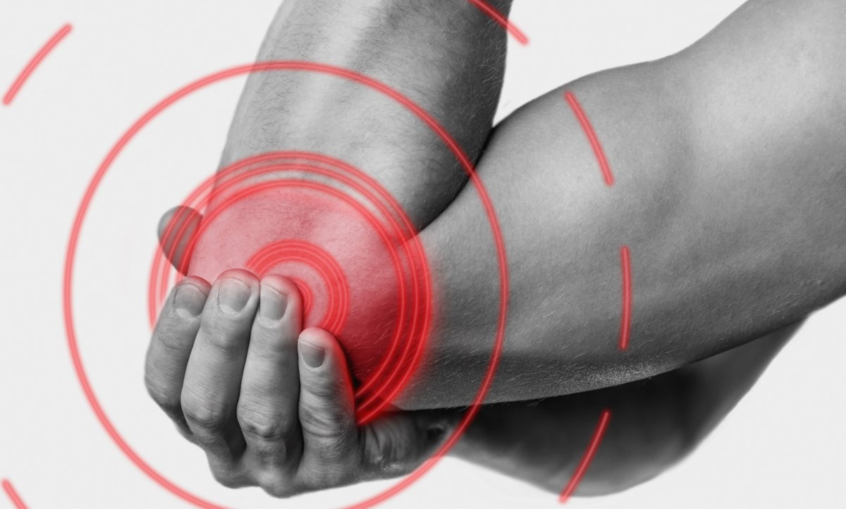 Cubital Tunnel Syndrome Exercise to Relieve Pain
